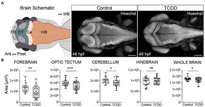 Proper modulation of AHR signaling is necessary for establishing neural connectivity and oligodendrocyte precursor cell development in the embryonic zebrafish brain